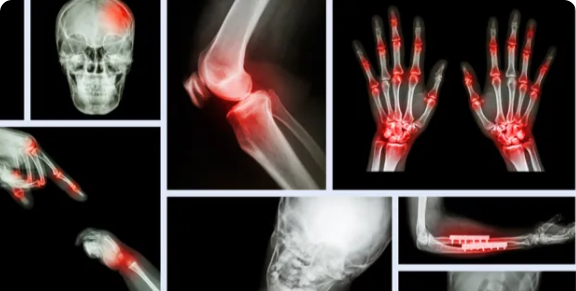 Klassifizierung medizinischer Objekte