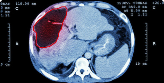 Erkennung von medizinischen Objekten