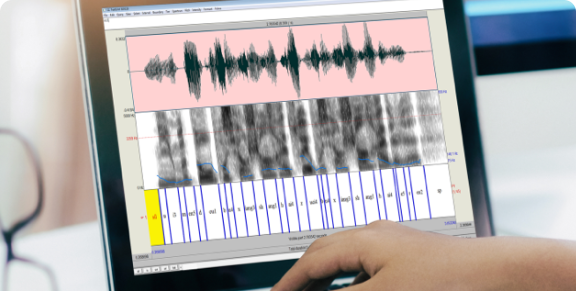 Phonem-Segmentierung